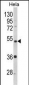 PPP2R2B Antibody (Center)